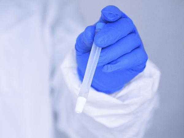 Reporta Salud 52 nuevos casos de dengue en la entidad