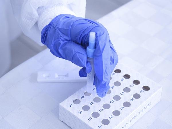 Registra Puebla 33 casos activos de COVID-19: Salud