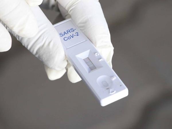 Permanecen ocho personas hospitalizadas por COVID-19: Salud