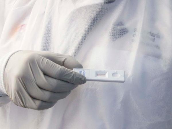 Registra Puebla 34 casos activos de COVID-19: Salud
