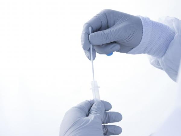 Atiende Salud 17 personas hospitalizadas por COVID-19