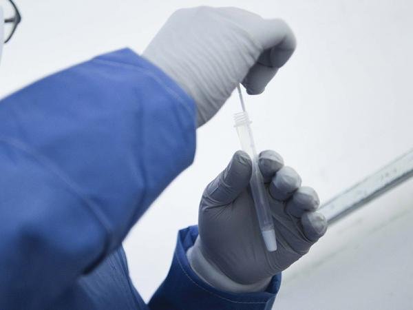 Suma Puebla siete nuevos contagios por COVID-19: Salud